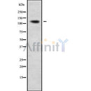 DF9174 at 1/100 staining Human kidney tissue by IHC-P. The sample was formaldehyde fixed and a heat mediated antigen retrieval step in citrate buffer was performed. The sample was then blocked and incubated with the antibody for 1.5 hours at 22¡ãC. An HRP conjugated goat anti-rabbit antibody was used as the secondary