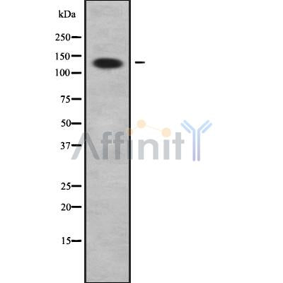 DF9175 staining HepG2 by IF/ICC. The sample were fixed with PFA and permeabilized in 0.1% Triton X-100,then blocked in 10% serum for 45 minutes at 25¡ãC. The primary antibody was diluted at 1/200 and incubated with the sample for 1 hour at 37¡ãC. An  Alexa Fluor 594 conjugated goat anti-rabbit IgG (H+L) Ab, diluted at 1/600, was used as the secondary antibod