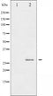 AF3081 staining HeLa by IF/ICC. The sample were fixed with PFA and permeabilized in 0.1% Triton X-100,then blocked in 10% serum for 45 minutes at 25¡ãC. The primary antibody was diluted at 1/200 and incubated with the sample for 1 hour at 37¡ãC. An  Alexa Fluor 594 conjugated goat anti-rabbit IgG (H+L) Ab, diluted at 1/600, was used as the secondary antibod