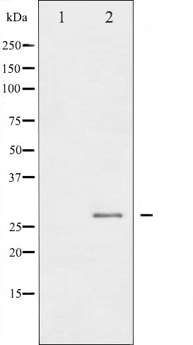 AF3081 staining HeLa by IF/ICC. The sample were fixed with PFA and permeabilized in 0.1% Triton X-100,then blocked in 10% serum for 45 minutes at 25¡ãC. The primary antibody was diluted at 1/200 and incubated with the sample for 1 hour at 37¡ãC. An  Alexa Fluor 594 conjugated goat anti-rabbit IgG (H+L) Ab, diluted at 1/600, was used as the secondary antibod