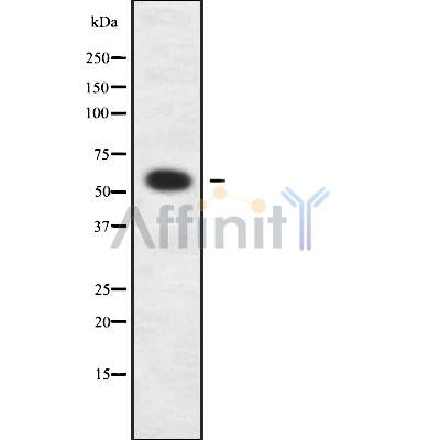 Western blot analysis of AGXT2L1 using HeLa whole cell lysates