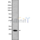 Western blot analysis of extracts from Mouse brain, using C9orf23 Antibody. Lane 1 was treated with the blocking peptide.