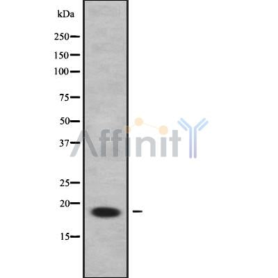 Western blot analysis of extracts from Mouse brain, using C9orf23 Antibody. Lane 1 was treated with the blocking peptide.