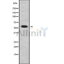 Western blot analysis of extracts from 293, using ALDH1A3 Antibody. Lane 1 was treated with the blocking peptide.