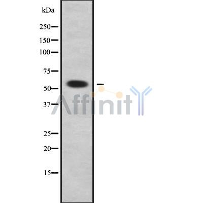 Western blot analysis of extracts from 293, using ALDH1A3 Antibody. Lane 1 was treated with the blocking peptide.
