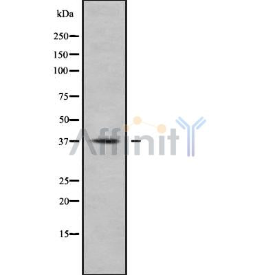 DF9189 at 1/100 staining Human uterus tissue by IHC-P. The sample was formaldehyde fixed and a heat mediated antigen retrieval step in citrate buffer was performed. The sample was then blocked and incubated with the antibody for 1.5 hours at 22¡ãC. An HRP conjugated goat anti-rabbit antibody was used as the secondary