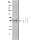 DF9191 at 1/100 staining Mouse kidney tissue by IHC-P. The sample was formaldehyde fixed and a heat mediated antigen retrieval step in citrate buffer was performed. The sample was then blocked and incubated with the antibody for 1.5 hours at 22¡ãC. An HRP conjugated goat anti-rabbit antibody was used as the secondary