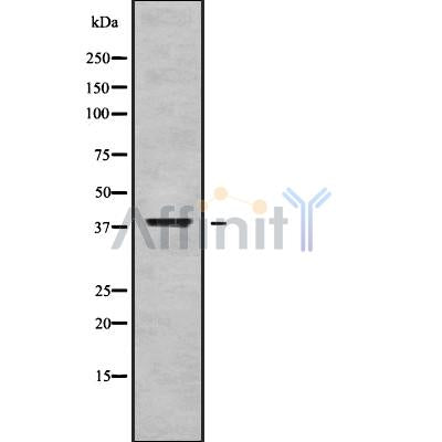 DF9191 at 1/100 staining Mouse kidney tissue by IHC-P. The sample was formaldehyde fixed and a heat mediated antigen retrieval step in citrate buffer was performed. The sample was then blocked and incubated with the antibody for 1.5 hours at 22¡ãC. An HRP conjugated goat anti-rabbit antibody was used as the secondary