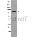 Western blot analysis of extracts from Mouse brain, using CTNNAL1 Antibody. Lane 1 was treated with the blocking peptide.