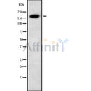 Western blot analysis of ALS2 using MCF7 whole cell lysates