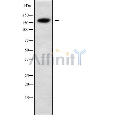 Western blot analysis of ALS2 using MCF7 whole cell lysates