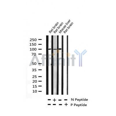 AF3083 at 1/100 staining Mouse intestine tissue by IHC-P. The sample was formaldehyde fixed and a heat mediated antigen retrieval step in citrate buffer was performed. The sample was then blocked and incubated with the antibody for 1.5 hours at 22¡ãC. An HRP conjugated goat anti-rabbit antibody was used as the secondary