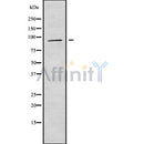 Western blot analysis of APBA1 using HeLa whole cell lysates