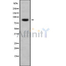 DF9203 at 1/100 staining Human brain cancer tissue by IHC-P. The sample was formaldehyde fixed and a heat mediated antigen retrieval step in citrate buffer was performed. The sample was then blocked and incubated with the antibody for 1.5 hours at 22¡ãC. An HRP conjugated goat anti-rabbit antibody was used as the secondary