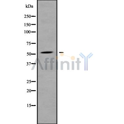 Western blot analysis of ALS2CR12 using COLO205 whole cell lysates