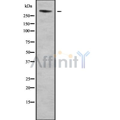Western blot analysis of ALS2CR16 using Jurkat whole cell lysates