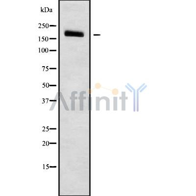 Western blot analysis of PDS5B using COLO205 whole cell lysates