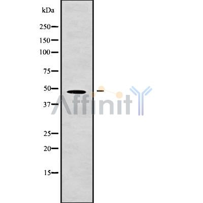 Western blot analysis of AAMP using HuvEc whole cell lysates