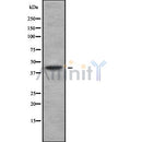 Western blot analysis of ANGPTL5 using COLO205 whole cell lysates