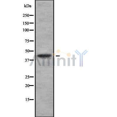 Western blot analysis of ANGPTL5 using COLO205 whole cell lysates