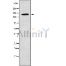 DF9212 at 1/100 staining Human urothelial cancer tissue by IHC-P. The sample was formaldehyde fixed and a heat mediated antigen retrieval step in citrate buffer was performed. The sample was then blocked and incubated with the antibody for 1.5 hours at 22¡ãC. An HRP conjugated goat anti-rabbit antibody was used as the secondary
