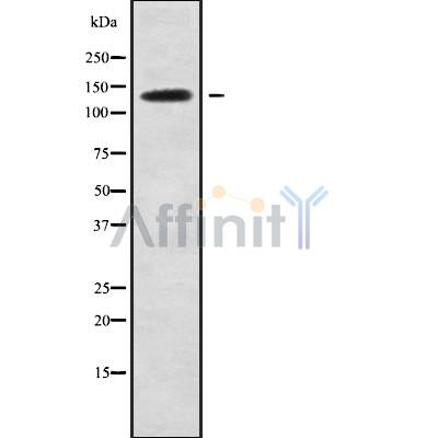 DF9212 at 1/100 staining Human urothelial cancer tissue by IHC-P. The sample was formaldehyde fixed and a heat mediated antigen retrieval step in citrate buffer was performed. The sample was then blocked and incubated with the antibody for 1.5 hours at 22¡ãC. An HRP conjugated goat anti-rabbit antibody was used as the secondary