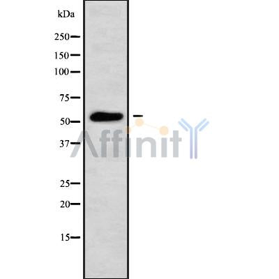 Western blot analysis of ANXA11 using HeLa whole cell lysates