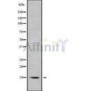 Western blot analysis of APOC4 using A549 whole cell lysates
