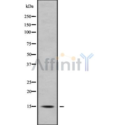 Western blot analysis of APOC4 using A549 whole cell lysates