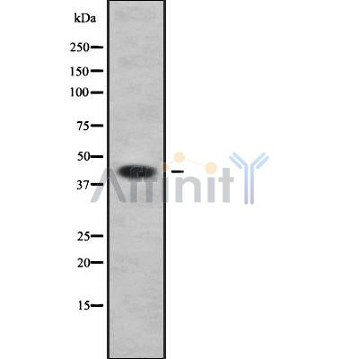 DF9217 at 1/100 staining Human pancreas tissue by IHC-P. The sample was formaldehyde fixed and a heat mediated antigen retrieval step in citrate buffer was performed. The sample was then blocked and incubated with the antibody for 1.5 hours at 22¡ãC. An HRP conjugated goat anti-rabbit antibody was used as the secondary