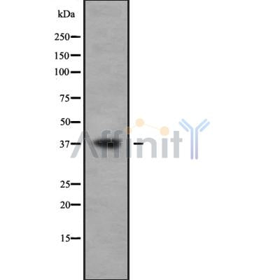 DF9220 at 1/100 staining Mouse testis tissue by IHC-P. The sample was formaldehyde fixed and a heat mediated antigen retrieval step in citrate buffer was performed. The sample was then blocked and incubated with the antibody for 1.5 hours at 22¡ãC. An HRP conjugated goat anti-rabbit antibody was used as the secondary