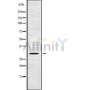 Western blot analysis of extracts from mouse brain, using AQP8 Antibody. Lane 1 was treated with the blocking peptide.