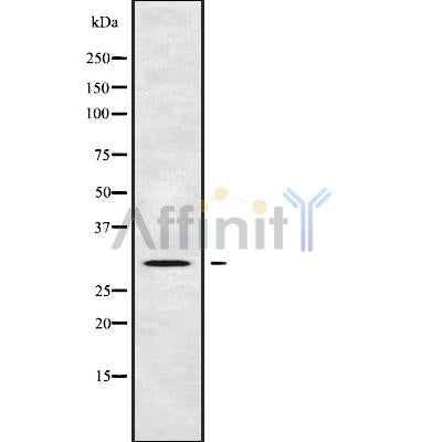 Western blot analysis of extracts from mouse brain, using AQP8 Antibody. Lane 1 was treated with the blocking peptide.
