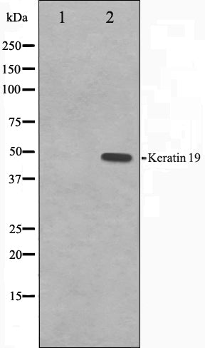 Western blot analysis on LOVO cell lysate using Keratin 19 Antibody. The lane on the left is treated with the antigen-specific peptide.