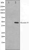 Western blot analysis on LOVO cell lysate using Keratin 19 Antibody. The lane on the left is treated with the antigen-specific peptide.