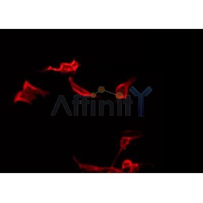 AF0192 staining LOVO by IF/ICC. The sample were fixed with PFA and permeabilized in 0.1% Triton X-100,then blocked in 10% serum for 45 minutes at 25¡ãC. The primary antibody was diluted at 1/200 and incubated with the sample for 1 hour at 37¡ãC. An  Alexa Fluor 594 conjugated goat anti-rabbit IgG (H+L) Ab, diluted at 1/600, was used as the secondary antibod