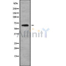 Western blot analysis of extracts from Mouse lung, using ARSJ Antibody. The lane on the left was treated with blocking peptide.