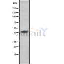 DF9235 at 1/100 staining Mouse lung tissue by IHC-P. The sample was formaldehyde fixed and a heat mediated antigen retrieval step in citrate buffer was performed. The sample was then blocked and incubated with the antibody for 1.5 hours at 22¡ãC. An HRP conjugated goat anti-rabbit antibody was used as the secondary