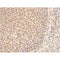 AF3087 staining K562 by IF/ICC. The sample were fixed with PFA and permeabilized in 0.1% Triton X-100,then blocked in 10% serum for 45 minutes at 25¡ãC. The primary antibody was diluted at 1/200 and incubated with the sample for 1 hour at 37¡ãC. An  Alexa Fluor 594 conjugated goat anti-rabbit IgG (H+L) Ab, diluted at 1/600, was used as the secondary antibod