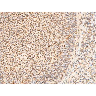AF3087 staining K562 by IF/ICC. The sample were fixed with PFA and permeabilized in 0.1% Triton X-100,then blocked in 10% serum for 45 minutes at 25¡ãC. The primary antibody was diluted at 1/200 and incubated with the sample for 1 hour at 37¡ãC. An  Alexa Fluor 594 conjugated goat anti-rabbit IgG (H+L) Ab, diluted at 1/600, was used as the secondary antibod