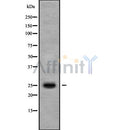 Western blot analysis of MT-ATP6 using LOVO whole cell lysates