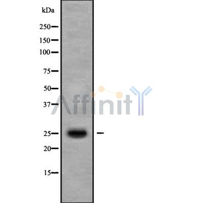 Western blot analysis of MT-ATP6 using LOVO whole cell lysates