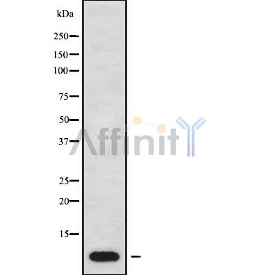 DF9238 at 1/100 staining Human breast cancer tissue by IHC-P. The sample was formaldehyde fixed and a heat mediated antigen retrieval step in citrate buffer was performed. The sample was then blocked and incubated with the antibody for 1.5 hours at 22¡ãC. An HRP conjugated goat anti-rabbit antibody was used as the secondary