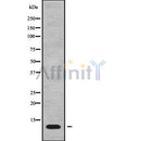 Western blot analysis of MT-ATP8 using Jurkat whole cell lysates