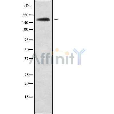 Western blot analysis of ABCA10 using Jurkat whole cell lysates