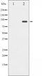 AF3088 staining HepG2 by IF/ICC. The sample were fixed with PFA and permeabilized in 0.1% Triton X-100,then blocked in 10% serum for 45 minutes at 25¡ãC. The primary antibody was diluted at 1/200 and incubated with the sample for 1 hour at 37¡ãC. An  Alexa Fluor 594 conjugated goat anti-rabbit IgG (H+L) Ab, diluted at 1/600, was used as the secondary antibod