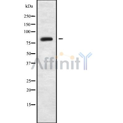 Western blot analysis of ABCD2 using HeLa whole cell lysates