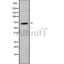 Western blot analysis of ABCG4 using COLO205 whole cell lysates