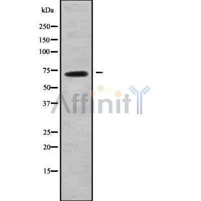 Western blot analysis of ABCG4 using COLO205 whole cell lysates