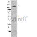 Western blot analysis of extracts from hepg2, using ABCC8 Antibody. Lane 1 was treated with the blocking peptide.